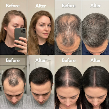 Newplum 01: Hair Growth Serum